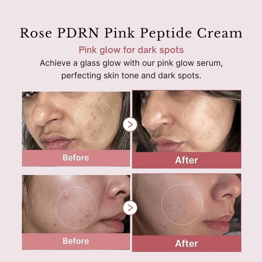 PDRN Pink Collagen Capsule Cream - skinfleur