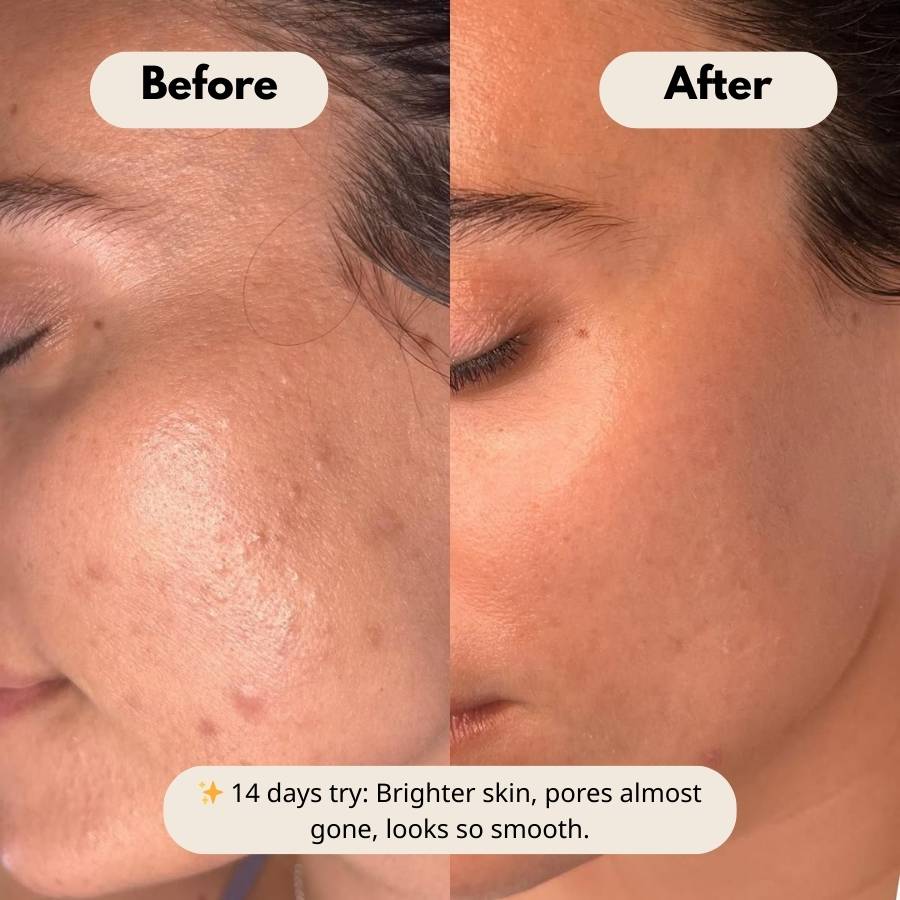 Peel Shot Glow Duo: White Rice Brightening & Black Rice Refining Ampoules (Buy 1 Get 1 Free) - skinfleur