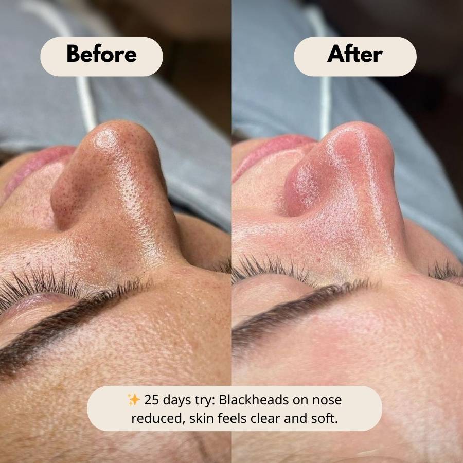 Peel Shot Glow Duo: White Rice Brightening & Black Rice Refining Ampoules (Buy 1 Get 1 Free) - skinfleur