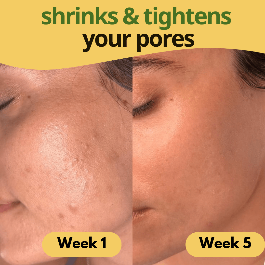 Turmeric & Kojic Acid Pads - skinfleur