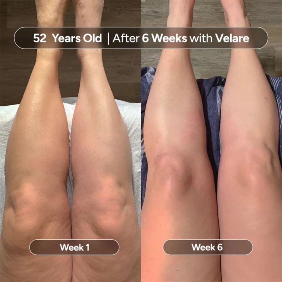 M3 Anti - Cellulite Massage Oil - SkinViral