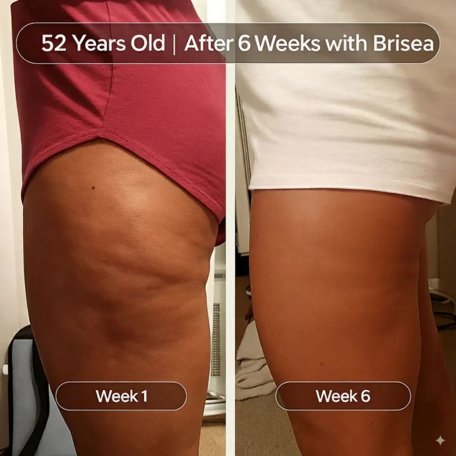 M3 Anti - Cellulite Massage Oil - SkinViral