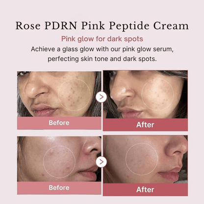 PDRN Pink Collagen Capsule Cream - skinfleur