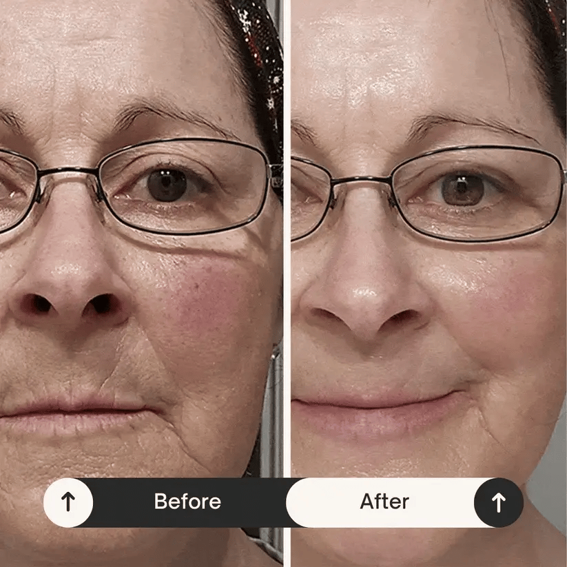 Skinfleur™ Silk Peptide Intensive Lifting Ampoule - skinfleur