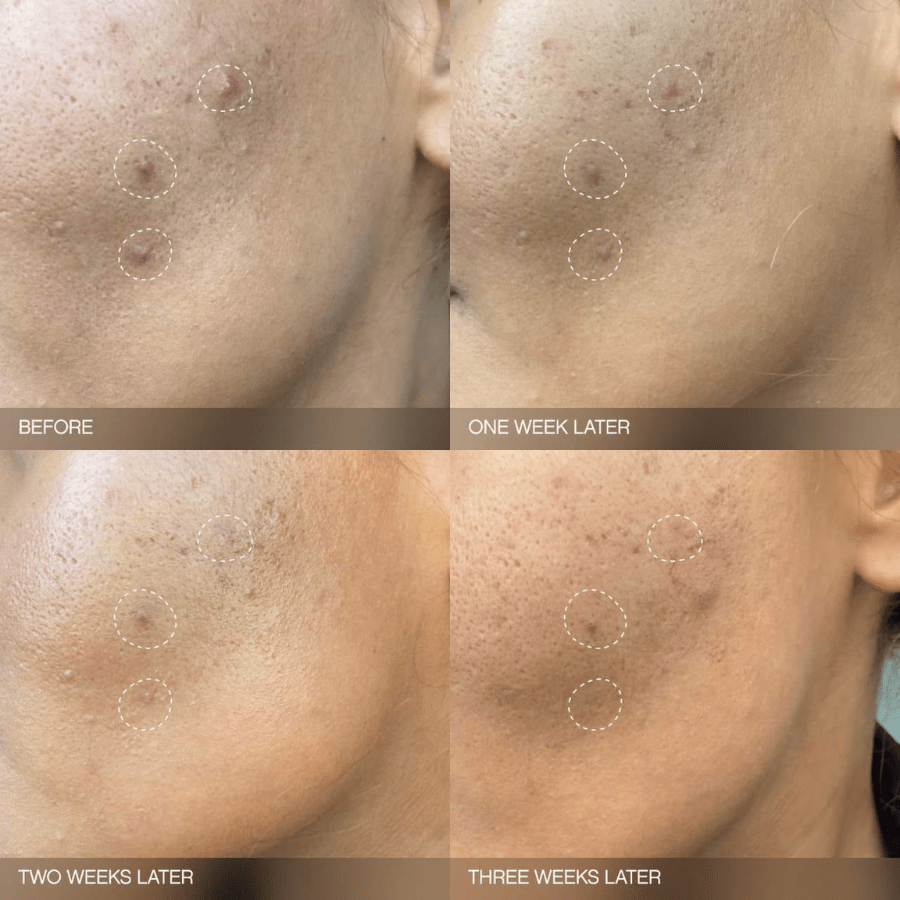 Topicals Faded Brightening and Clearing Serum - SkinViral