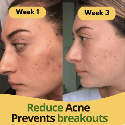 Turmeric & Kojic Acid Pads - skinfleur