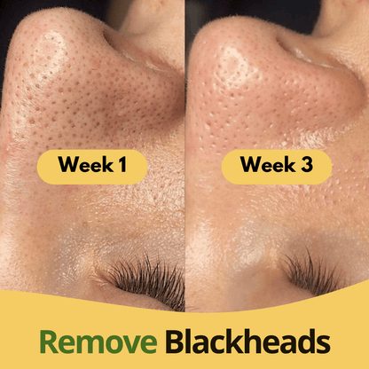 Turmeric & Kojic Acid Pads - skinfleur